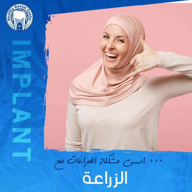 زراعة الأسنان